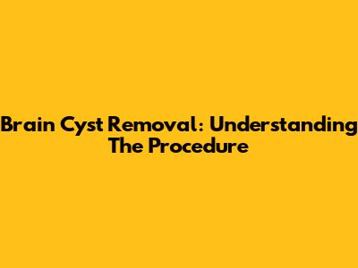 Brain Cyst Removal: Understanding The Procedure
